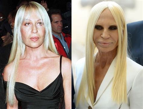 before and after donatella versace|donatella versace plastic surgery 2022.